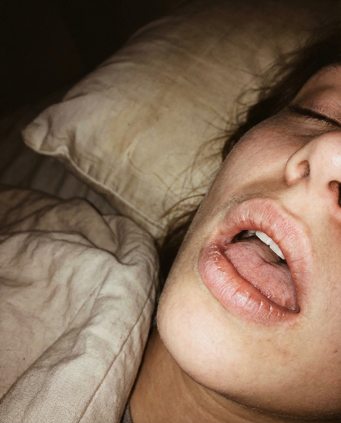 Respiration Buccale Nocturne : Halte à la Bouche Sèche !